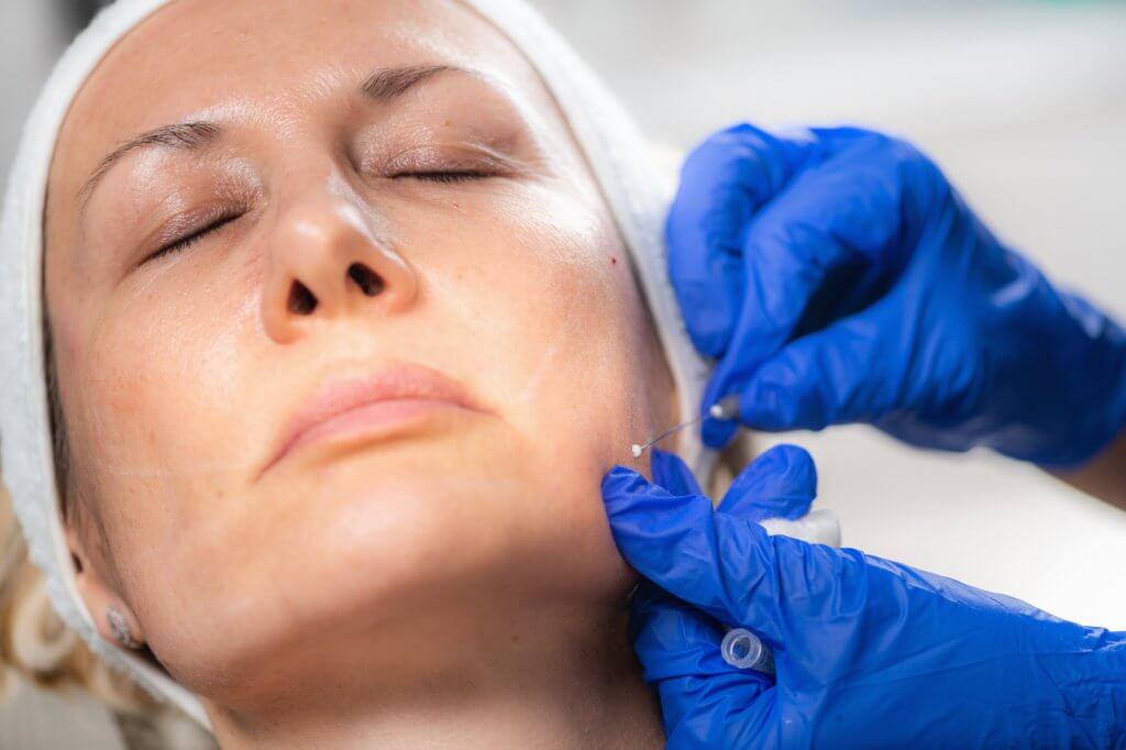 Aesthetic Medicine Facial Contouring with 3D Meso Threads.